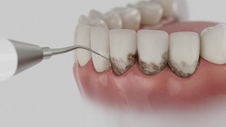 Reliable Dental Implants contractor in Valley, NE by Smile Center Dentistry
